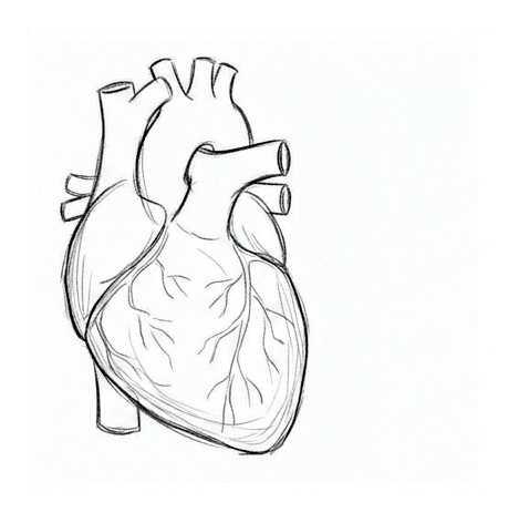Coronary Artery Disease — educational illustration