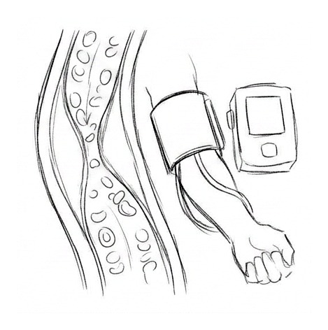 High Blood Pressure: Risks and Management — educational illustration