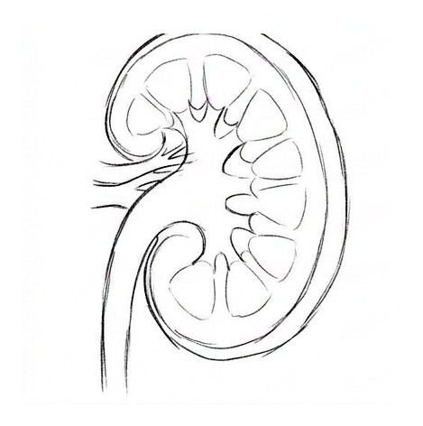 Kidney Stones — educational illustration
