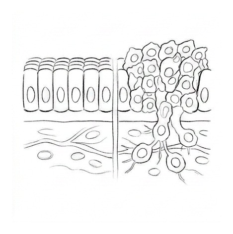 Cancer Biology and Diagnosis — educational illustration